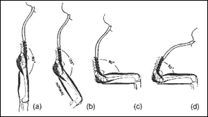 fig3.gif